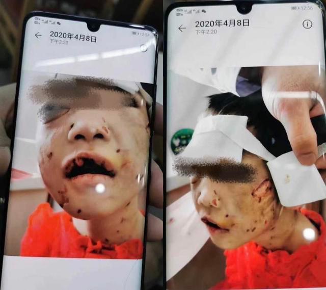 玩手机家暴孩子新闻家暴法律如何认定家暴孩子-第1张图片-亚星国际官网